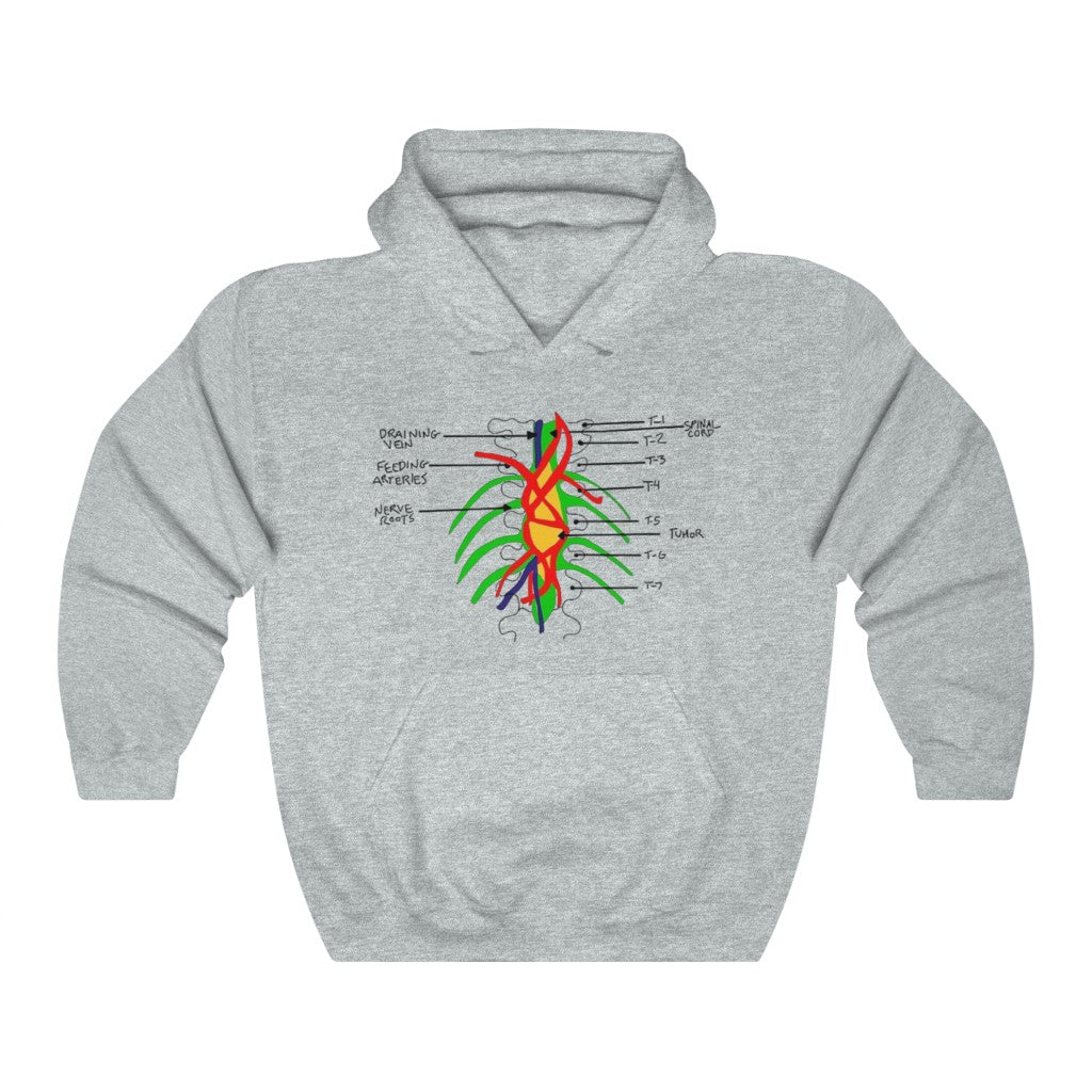 Tumor on the Wall Hoodie All About Greys